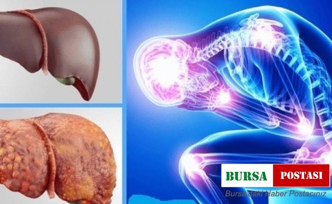 Karaciğer nakilleri arttı, hastalık önlenebilir