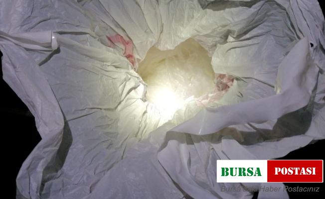 Yüz nakli yapılan Recep Sert gözaltına alındı